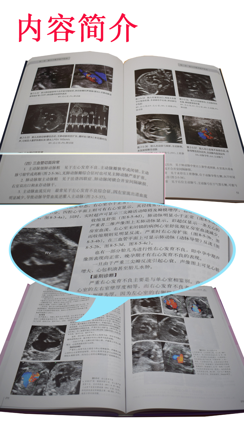 京东自营 正版 套装 中国胎儿产前超声检查规范 产前超声诊断学(第2版