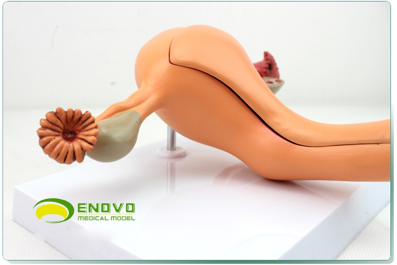 enovo颐诺医学 女性内生殖器官模型子宫卵巢生殖结构妇产科模型子宫
