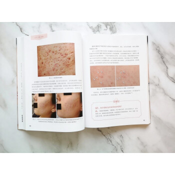 听肌肤的话2：问题肌肤护理全书